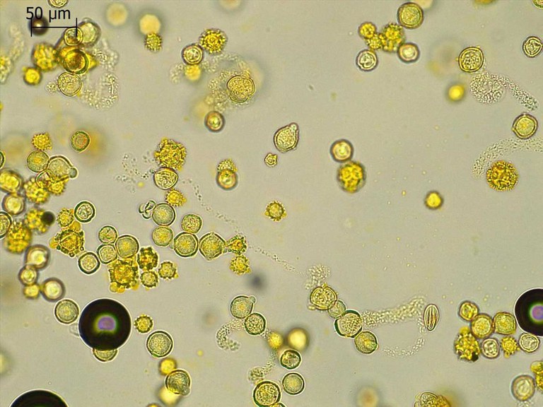 Pollen_load_of_a_collected_insect.jpg